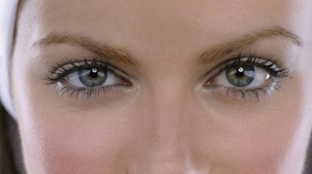 Women eyes after Blepharoplasty Recovery