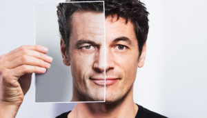Dr. Vitenas provides expert tips for a facelift on male patients.