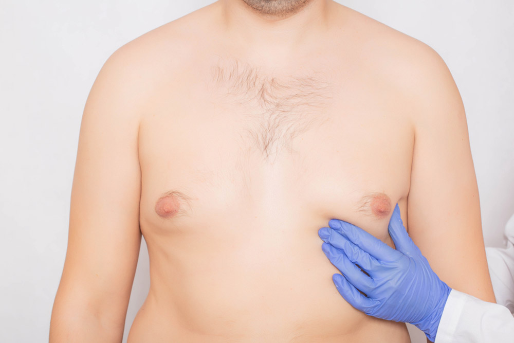 Gynecomastia surgery is a procedure designed to reduce the amount of excess breast tissue in men, giving them a flatter and more contoured chest.