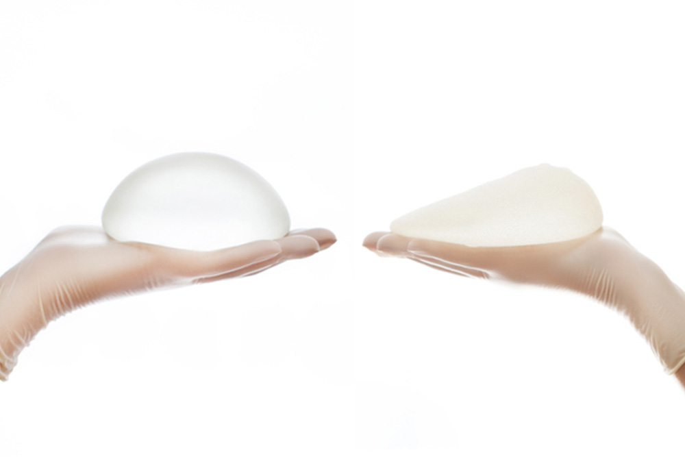 Breast implant exchange can also be used to address medical issues such as capsular contracture, implant rupture, or infection