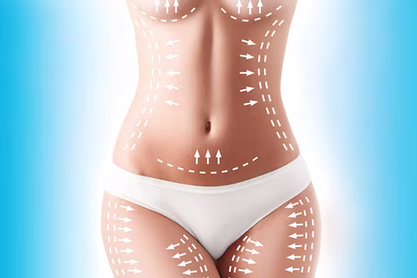 Body lift help to reduce excess skin and fat in these areas for a more toned and sculpted appearance.
