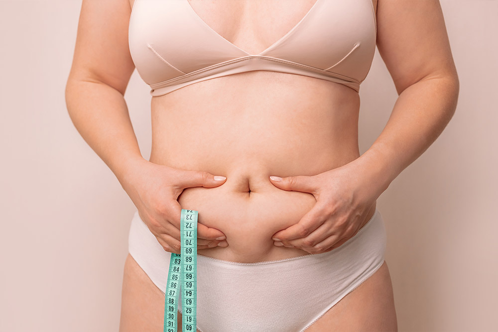 Plastic surgery after weight loss is typically reserved for those who have lost a significant amount of weight but still have areas that need additional contouring or reshaping.