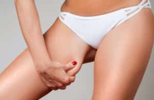 Close-up of a person holding their thigh to depict recovery stages after a thigh lift.