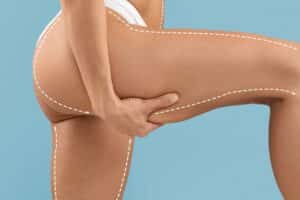 Detailed thigh lift surgery options for body enhancement.