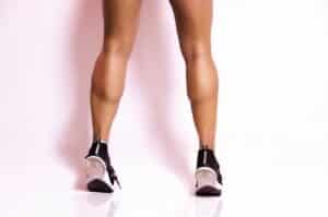 Enhancing leg silhouette with calf implants