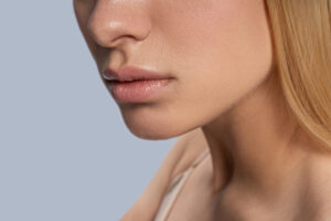 Close-up of a woman's lower face highlighting contoured cheek post-buccal fat removal.
