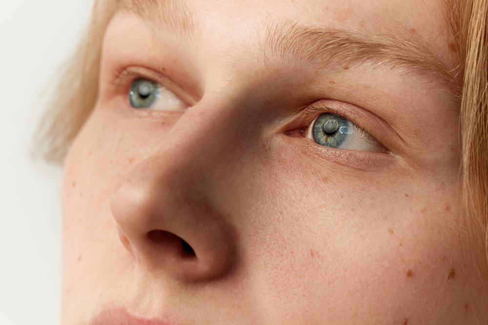 Close-up of eyes with focus on the brow, indicative of targeted brow lift approaches.