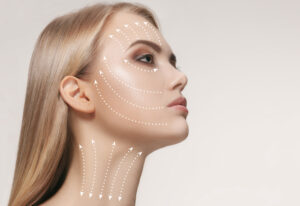 Side profile of a woman with dotted lines marking potential Botox or Xeomin injection sites.