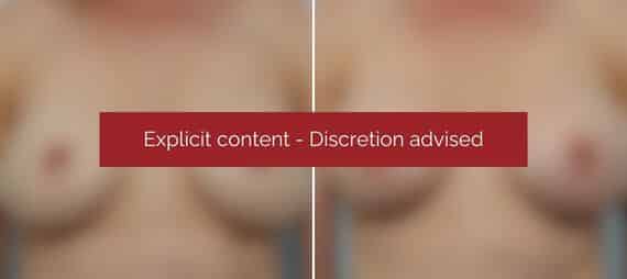 image blur
