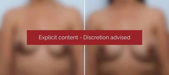 image blur