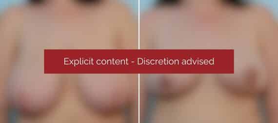 image blur