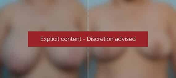 image blur