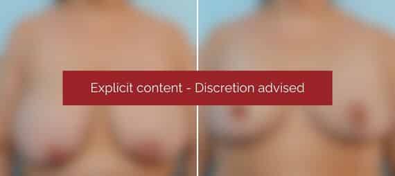 image blur