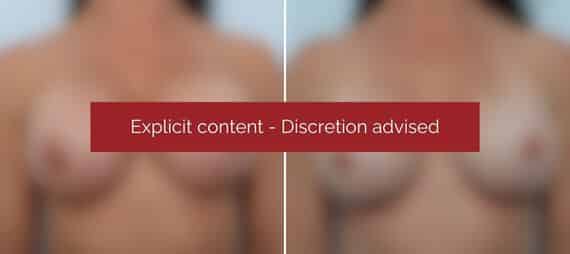 image blur