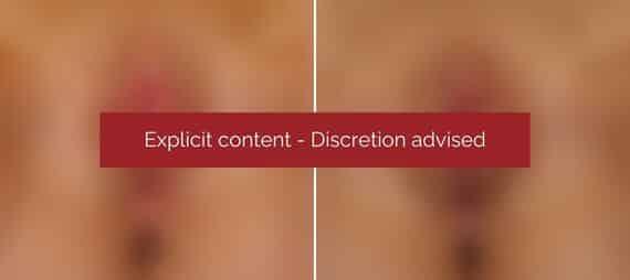 image blur