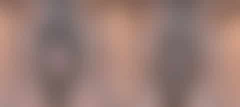 Vaginoplasty before and after photos in Houston, TX