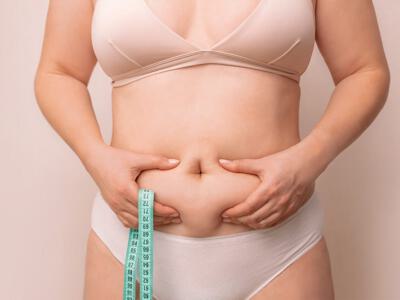Plastic surgery after weight loss is typically reserved for those who have lost a significant amount of weight but still have areas that need additional contouring or reshaping.