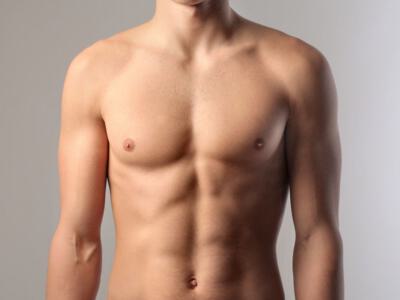 Dr. Vitenas is a highly skilled professional at gynecomastia treatment in Houston, TX.