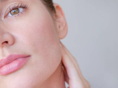 Half-face view of a woman experiencing natural swelling post buccal fat removal surgery.