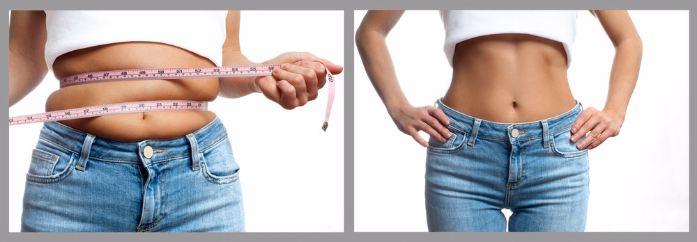 Liposuction isn't a weight loss surgery. Instead, it's designed to get rid of those areas of stubborn fat. Dr. Paul Vitenas | Houston, TX